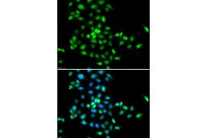 Immunofluorescence analysis of MCF-7 cells using SBDS antibody.
