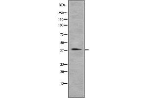 Western blot analysis of CCRL2 using A549 whole cell lysates (CCRL2 anticorps  (Internal Region))
