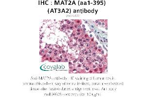 Image no. 2 for anti-Methionine Adenosyltransferase II, alpha (MAT2A) (AA 1-395) antibody (ABIN1724355) (MAT2A anticorps  (AA 1-395))