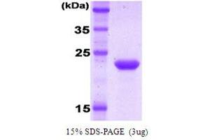 SDS-PAGE (SDS) image for Killer Cell Immunoglobulin-Like Receptor, Two Domains, Long Cytoplasmic Tail, 1 (KIR2DL1) protein (ABIN666833) (KIR2DL1 Protéine)