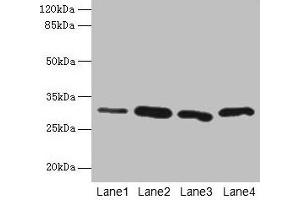 Western blot All lanes: CA3 antibody at 2 μg/mL Lane 1: Hela whole cell lysate Lane 2: HepG2 whole cell lysate Lane 3: K562 whole cell lysate Lane 4: NIH/3T3 whole cell lysate Secondary Goat polyclonal to rabbit IgG at 1/10000 dilution Predicted band size: 30 kDa Observed band size: 30 kDa (CA3 anticorps  (AA 2-260))