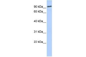 WB Suggested Anti-NOTCH2 Antibody Titration:  0. (NOTCH2 anticorps  (Middle Region))
