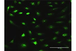 Immunofluorescence of purified MaxPab antibody to RRS1 on HeLa cell. (RRS1 anticorps  (AA 1-365))