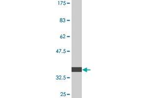 Western Blot detection against Immunogen (36. (PIK3R4 anticorps  (AA 1259-1358))