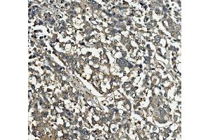 IHC analysis of Clathrin heavy chain/CLTC using anti-Clathrin heavy chain/CLTC antibody (ABIN7602703). (Clathrin Heavy Chain (CLTC) (AA 967-1668) anticorps)