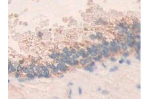 Detection of MMP24 in Human Prostate Tissue using Polyclonal Antibody to Matrix Metalloproteinase 24 (MMP24)