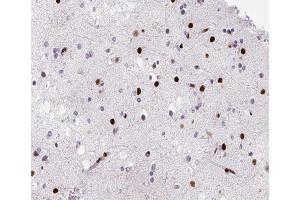 ABIN6266483 at 1/200 staining human brain tissue sections by IHC-P. (HNRNPD/AUF1 anticorps  (Internal Region))