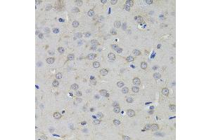 Immunohistochemistry of paraffin-embedded rat brain using AMPD1 antibody. (AMPD1 anticorps)