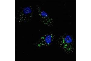 Fluorescent image of U251 cells stained with p62 antibody at 1:200.