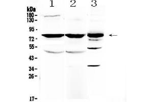 Western blot analysis of NSF using anti-NSF antibody .