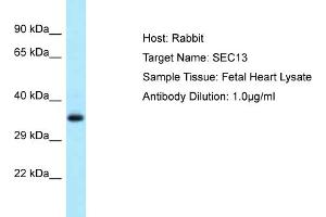 Host: Rabbit Target Name: SEC13 Sample Type: Fetal Heart lysates Antibody Dilution: 1.
