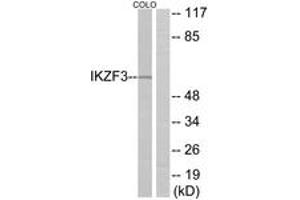 Western Blotting (WB) image for anti-IKAROS Family Zinc Finger 3 (Aiolos) (IKZF3) (AA 361-410) antibody (ABIN2889804) (IKZF3 anticorps  (AA 361-410))