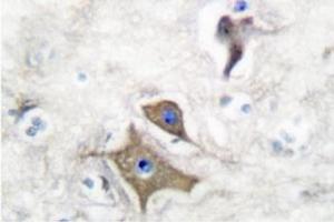 Image no. 2 for anti-Enolase 2 (Gamma, Neuronal) (ENO2) antibody (ABIN271752) (ENO2/NSE anticorps)
