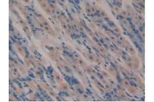 Detection of VIP in Mouse Stomach Tissue using Polyclonal Antibody to Vasoactive Intestinal Peptide (VIP)