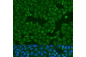 Immunofluorescence analysis of U2OS cells using KRT6B Polyclonal Antibody at dilution of 1:100. (Keratin 6B anticorps)