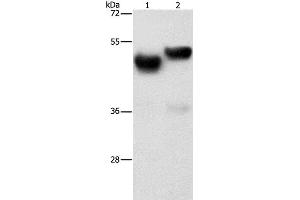Western Blot analysis of Human fetal brain and liver tissue using AMZ1 Polyclonal Antibody at dilution of 1:1000 (AMZ1 anticorps)