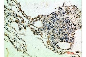Immunohistochemical analysis of paraffin-embedded human-lung, antibody was diluted at 1:200 (THBS4 anticorps  (AA 551-600))