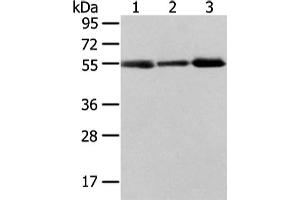 Gel: 8 % SDS-PAGE, Lysate: 40 μg, Lane 1-3: Human normal stomach tissue, human liver cancer and thyroid cancer tissue, Primary antibody: ABIN7193079(XKRX Antibody) at dilution 1/400 dilution, Secondary antibody: Goat anti rabbit IgG at 1/8000 dilution, Exposure time: 2 minutes