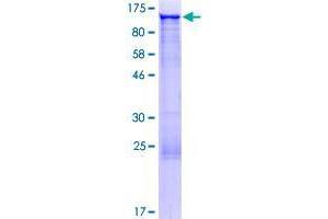 Image no. 1 for GRIP and Coiled-Coil Domain Containing 1 (GCC1) (AA 1-775) protein (GST tag) (ABIN1354900)