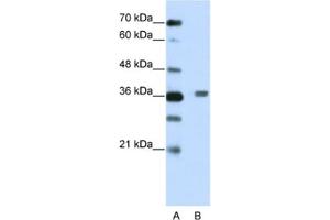 Western Blotting (WB) image for anti-BTB (POZ) Domain Containing 6 (BTBD6) antibody (ABIN2461967) (BTBD6 anticorps)