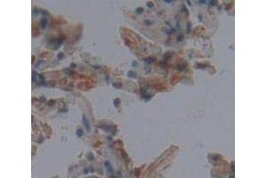 Figure. (Peroxiredoxin 3 anticorps  (AA 5-233))
