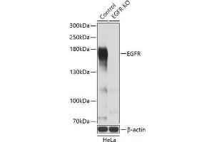 Western blot analysis of extracts from normal (control) and EGFR knockout (KO) HeLa cells using EGFR Polyclonal Antibody at dilution of 1:3000.