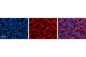 KRT8 Antibody          Formalin Fixed Paraffin Embedded Tissue:  Human Liver Tissue    Observed Staining:  Cytoplasm and membrane of hepatocytes   Primary Antibody Concentration:  1:100    Other Working Concentrations:  1/600    Secondary Antibody:  Donkey anti-Rabbit-Cy3    Secondary Antibody Concentration:  1:200    Magnification:  20X    Exposure Time:  0.