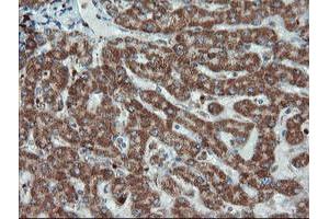 Image no. 5 for anti-Ubiquitin-Conjugating Enzyme E2E 3 (UBE2E3) antibody (ABIN1501617)