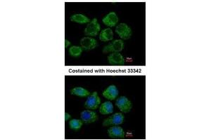 ICC/IF Image Immunofluorescence analysis of paraformaldehyde-fixed A431, using G protein alpha Inhibitor 2, antibody at 1:500 dilution. (GNAI2 anticorps  (Center))