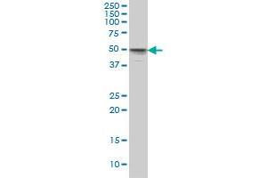 MKNK1 monoclonal antibody (M08), clone 2H8 Western Blot analysis of MKNK1 expression in HeLa . (MKNK1 anticorps  (AA 1-465))