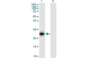 Western Blot analysis of RRAS2 expression in transfected 293T cell line by RRAS2 monoclonal antibody (M01A), clone 2D3-4B8.