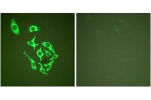 Immunofluorescence analysis of HepG2 cells, using HSP60 Antibody.