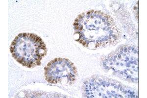 anti-General Transcription Factor IIB (GTF2B) (AA 129-178) antibody