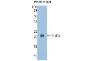 Western Blotting (WB) image for anti-Histone Deacetylase 6 (HDAC6) (AA 1038-1204) antibody (ABIN1859131) (HDAC6 anticorps  (AA 1038-1204))