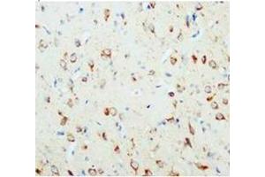 Immunohistochemical analysis of paraffin embedded rat tissue sections (brain), staining NGFbeat in cytoplasm, DAB chromogenic reaction