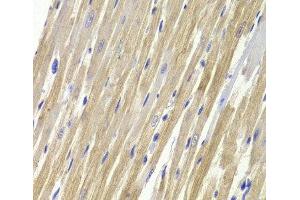 Immunohistochemistry of paraffin-embedded Rat heart using GPD1 Polyclonal Antibody at dilution of 1:100 (40x lens). (GPD1 anticorps)