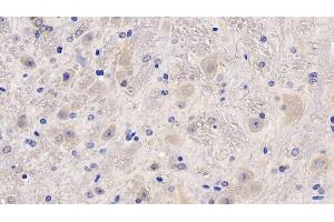 Detection of MCSF in Mouse Cerebellum Tissue using Polyclonal Antibody to Colony Stimulating Factor 1, Macrophage (MCSF)