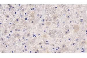Detection of MCSF in Mouse Cerebellum Tissue using Polyclonal Antibody to Colony Stimulating Factor 1, Macrophage (MCSF) (M-CSF/CSF1 anticorps  (AA 261-427))