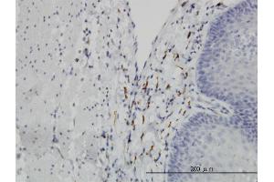 Immunoperoxidase of monoclonal antibody to LEPRE1 on formalin-fixed paraffin-embedded human esophagus.