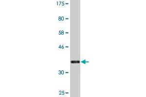 Western Blot detection against Immunogen (37.
