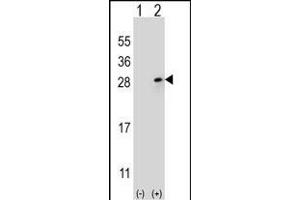Western blot analysis of FGF9 (arrow) using rabbit polyclonal FGF9 Antibody (N-term) (ABIN654171 and ABIN2844030).
