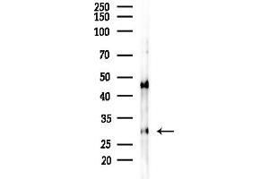 anti-Ribosomal Protein S4, X-Linked (RPS4X) (Internal Region) antibody