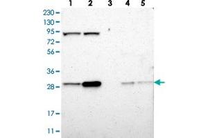 Western blot analysis of Lane 1: RT-4, Lane 2: U-251 MG, Lane 3: Human Plasma, Lane 4: Liver, Lane 5: Tonsil with CLIC4 polyclonal antibody  at 1:250-1:500 dilution. (CLIC4 anticorps)