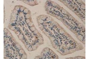 Immunohistochemical staining of formalin-fixed paraffin-embedded human small intestine tissue with ADAM17 polyclonal antibody  at 1 : 100 dilution.