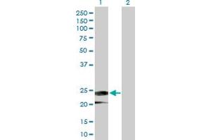 IFNa14 anticorps  (AA 1-189)