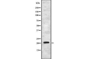 Western blot analysis of MRPS11 using MCF7 whole cell lysates