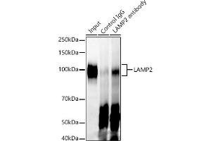 Immunoprecipitation analysis of 300 μg extracts of A-549 cells using 3 μg L antibody . (LAMP2 anticorps)