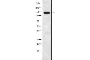Western blot analysis of CTNND2 using COLO205 whole cell lysates (CTNND2 anticorps  (C-Term))