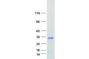 Validation with Western Blot