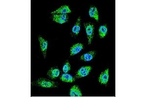Confocal immunofluorescent analysis of MIC1 Antibody (N-term) (ABIN655711 and ABIN2845162) with MDA-MB cell followed by Alexa Fluor 488-conjugated goat anti-rabbit lgG (green). (C18orf8 anticorps  (N-Term))